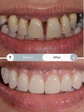 The Perfect Smile Studios