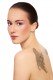 Laser Tattoo Removal