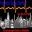 Hospital Radio Stafford logo