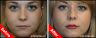 Lip Enhancement from just Â£199