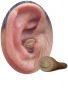 canal in ear with canal