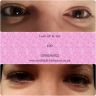 Lash lift 