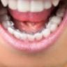 Dental