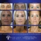 SWiCH Dermal Rejuvenation