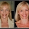 Beautiful smile creation