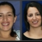 Restored dental beauty