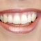 Smile, tooth whitening, cosmetic dentistry