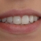 smile, tooth whitening, cosmetic dentistry
