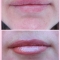lips