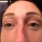 Eyelash Perming (Before)