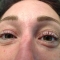 Eyelash Perming (After)