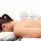 Cupping Therapy