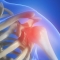 Physiotherapy