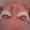 eyelash extension