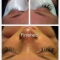 eyelash extensions
