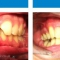 case 2