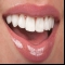 Dental-veneers-Birmingham