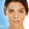 Skin Treatments